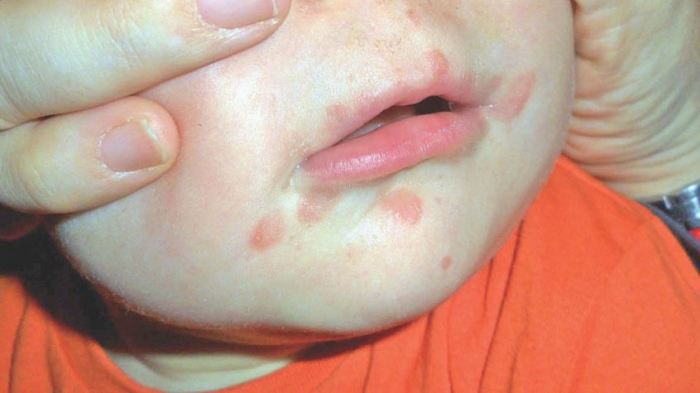 19554907_734443393426121_5513278424284042564_n